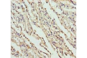 Immunohistochemistry of paraffin-embedded human lung tissue using ABIN7149964 at dilution of 1:100 (FMO5 抗体  (AA 1-285))
