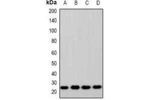 Western blot analysis of ZNRF2 expression in HEK293T (A), A549 (B), RAW264. (ZNRF2 抗体  (C-Term))