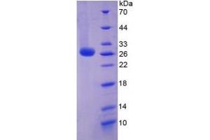 SDS-PAGE (SDS) image for Interleukin 6 (IL6) ELISA Kit (ABIN6574135)