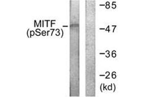 Western blot analysis of extracts from COS7 cells, using MITF (Phospho-Ser180/73) Antibody. (MITF 抗体  (pSer180))