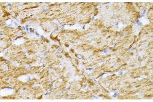 Immunohistochemistry (Paraffin-embedded Sections) (IHC (p)) image for anti-Solute Carrier Family 25 (Mitochondrial Carrier, Adenine Nucleotide Translocator), Member 5 (SLC25A5) antibody (ABIN7258544)
