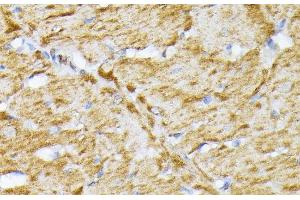 Immunohistochemistry of paraffin-embedded Rat heart using SLC25A5 Polyclonal Antibody at dilution of 1:100 (40x lens). (SLC25A5 抗体)