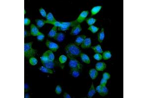 IF analysis of eRF1/ETF1 using anti-eRF1/ETF1 antibody (ABIN7602626).