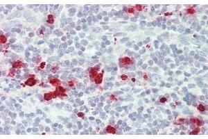Detection of GZMM in Human Tonsil Tissue using Monoclonal Antibody to Granzyme M (GZMM) (GZMM 抗体  (AA 26-257))