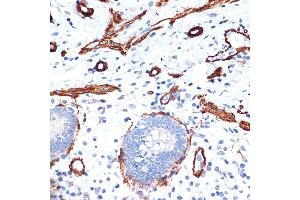 Immunohistochemistry of paraffin-embedded human appendix using α-Actin-1  Rabbit mAb (ABIN1682816, ABIN7101454, ABIN7101455 and ABIN7101456) at dilution of 1:100 (40x lens).