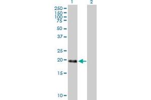 Western Blot analysis of MBD3L1 expression in transfected 293T cell line by MBD3L1 MaxPab polyclonal antibody. (MBD3L1 抗体  (AA 1-194))