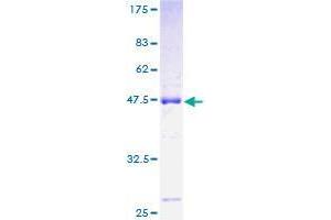 ROBO3 Protein (AA 1-147) (GST tag)