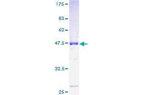 ROBO3 Protein (AA 1-147) (GST tag)