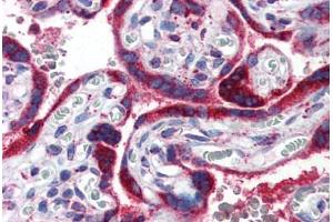 Human Placenta (formalin-fixed, paraffin-embedded) stained with PPARG antibody ABIN351540 at 2. (PPARG 抗体  (AA 1-16))