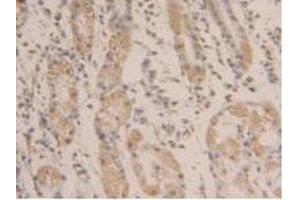 Immunohistochemistry (IHC) image for anti-Glyceraldehyde-3-Phosphate Dehydrogenase (GAPDH) (AA 154-324) antibody (ABIN7438157)