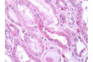 Immunohistochemistry (Paraffin-embedded Sections) (IHC (p)) image for anti-Glutamate Receptor, Metabotropic 3 (GRM3) (N-Term) antibody (ABIN1048932)