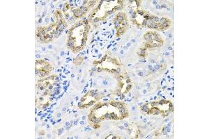 Immunohistochemistry of paraffin-embedded rat kidney using CDC antibody (ABIN6127612, ABIN6138273, ABIN6138274 and ABIN6216282) at dilution of 1:100 (40x lens). (CDCA8 抗体  (AA 1-280))