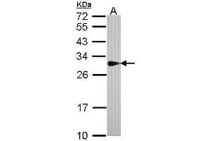 WB Image Sample (30 ug of whole cell lysate) A: A431 , 12% SDS PAGE antibody diluted at 1:1000 (SPR 抗体)