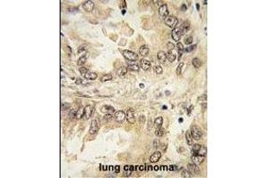 Immunohistochemistry (Paraffin-embedded Sections) (IHC (p)) image for anti-SRY (Sex Determining Region Y)-Box 2 (SOX2) (AA 89-119), (N-Term) antibody (ABIN388797)