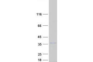 Western Blotting (WB) image for Solute Carrier Family 25, Member 42 (SLC25A42) protein (Myc-DYKDDDDK Tag) (ABIN2732165)