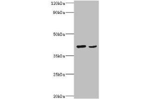 Western blot All lanes: Protein Wnt-2 antibody at 2 μg/mL Lane 1: HepG2 whole cell lysate Lane 2: MCF-7 whole cell lysate Secondary Goat polyclonal to rabbit IgG at 1/10000 dilution Predicted band size: 40 kDa Observed band size: 40 kDa (WNT2 抗体  (AA 26-360))