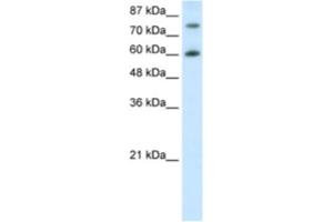 Western Blotting (WB) image for anti-Cleavage Stimulation Factor, 3' Pre-RNA, Subunit 3, 77kDa (CSTF3) antibody (ABIN2462105) (CSTF3 抗体)