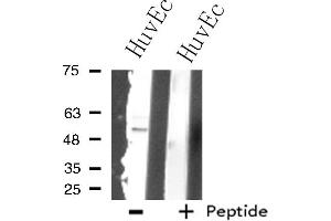 Western blot analysis of extracts from HuvEc cells using SUPT3 antibody. (SUPT3H/SPT3 抗体  (Internal Region))