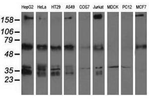Image no. 2 for anti-Insulin-Like Growth Factor 2 mRNA Binding Protein 2 (IGF2BP2) antibody (ABIN1498825) (IGF2BP2 抗体)