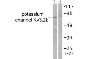 Western blot analysis of extracts from HepG2 cells, using Potassium Channel Kv3. (Kv3.2b Potassium Channel 抗体  (C-Term))