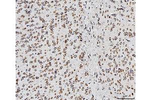 IHC analysis of RPL10 using anti-RPL10 antibody (ABIN7601177). (RPL10 抗体  (AA 3-214))