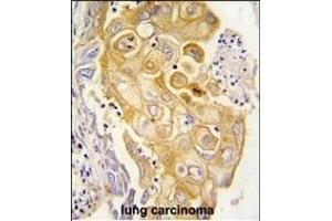 Immunohistochemistry (Paraffin-embedded Sections) (IHC (p)) image for anti-Prostaglandin I2 (Prostacyclin) Synthase (PTGIS) (AA 30-61), (N-Term) antibody (ABIN392532)