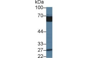 Western Blotting (WB) image for anti-Abl-Interactor 1 (ABI1) (AA 1-182) antibody (ABIN7436735)