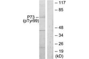 Western blot analysis of extracts from K562 cells treated with Pervanadate, using p73 (Phospho-Tyr99) Antibody. (Tumor Protein p73 抗体  (pTyr99))