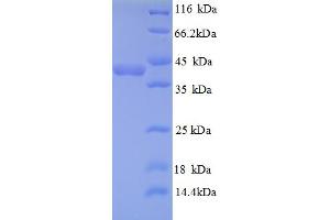 TXNDC17 Protein (AA 1-123, full length) (GST tag)