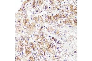 Immunohistochemistry of paraffin-embedded human liver using CYP3 antibody (ABIN3023345, ABIN3023346, ABIN3023347 and ABIN6219639) at dilution of 1:100 (40x lens). (CYP3A4 抗体  (AA 244-503))