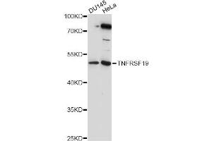 Western blot analysis of extracts of various cell lines, using TNFRSF19 antibody (ABIN6290995) at 1:1000 dilution. (TNFRSF19 抗体)