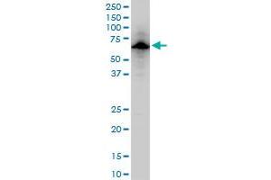 USP14 polyclonal antibody (A01), Lot # 060707JCS1. (USP14 抗体  (AA 395-494))