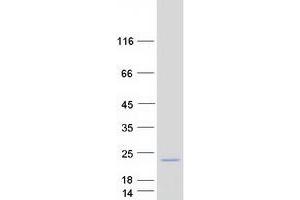 Western Blotting (WB) image for Organic Solute Transporter beta (OSTBETA) protein (Myc-DYKDDDDK Tag) (ABIN2727932)