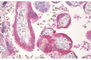 Anti-CGB / hCG Beta antibody IHC staining of human placenta, trophoblast. (CGB 抗体  (AA 101-150))