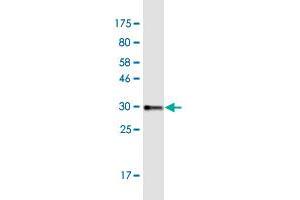 Western Blotting (WB) image for anti-Collagen, Type VIII, alpha 2 (COL8A2) (AA 626-696) antibody (ABIN1327109)