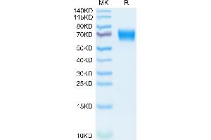 Mouse IL-18 R1 on Tris-Bis PAGE under reduced condition.