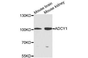 Western blot analysis of extracts of various cell lines, using ADCY1 antibody (ABIN5996345) at 1/1000 dilution. (ADCY1 抗体)