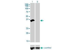 Western blot analysis of HOXD8 over-expressed 293 cell line, cotransfected with HOXD8 Validated Chimera RNAi (Lane 2) or non-transfected control (Lane 1). (HOXD8 抗体  (AA 126-190))