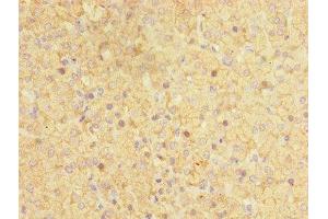 Immunohistochemistry (IHC) image for anti-Cytochrome P450, Family 17, Subfamily A, Polypeptide 1 (CYP17A1) (AA 1-508) antibody (ABIN7170749)