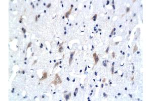Formalin-fixed and paraffin embedded rat brain labeled with Anti- 5-HTR3Polyclonal Antibody, Unconjugated (ABIN677813) followed by conjugation to the secondary antibody and DAB staining (Serotonin Receptor 3A 抗体  (AA 301-400))