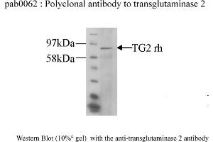 Image no. 1 for anti-Transglutaminase 2 (C Polypeptide, Protein-Glutamine-gamma-Glutamyltransferase) (TGM2) antibody (ABIN347018) (Transglutaminase 2 抗体)