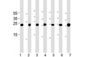 Cebpd antibody western blot analysis in 1) A549, 2) HeLa, 3) NCI-H460, 4) U-937, 5) mouse NIH3T3 cell line, rat 6) lung and 7) testis tissue lysate. (CEBPD 抗体  (AA 161-189))