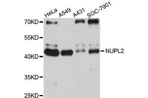Western blot analysis of extracts of various cell lines, using NUPL2 antibody (ABIN4904603) at 1:1000 dilution. (NUPL2 抗体)
