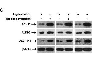 Western Blotting (WB) image for anti-Aldehyde Dehydrogenase 2 Family (Mitochondrial) (ALDH2) (AA 1-380) antibody (ABIN3021779)