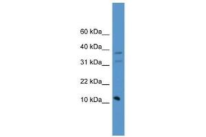 PSENEN antibody used at 0. (PEN2 抗体  (C-Term))
