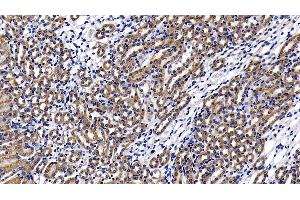 Detection of LY96 in Mouse Kidney Tissue using Polyclonal Antibody to Lymphocyte Antigen 96 (LY96) (LY96 抗体  (AA 19-130))