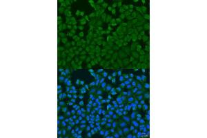 Immunofluorescence analysis of U2OS cells using IL27RA antibody. (IL27 Receptor alpha 抗体  (AA 33-283))