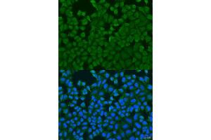 Immunofluorescence analysis of U2OS cells using IL27RA antibody. (IL27 Receptor alpha 抗体  (AA 33-283))
