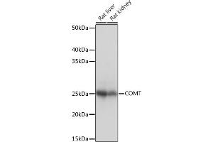 Western blot analysis of extracts of various cell lines, using COMT Rabbit mAb (ABIN1682443, ABIN3018925, ABIN3018926 and ABIN7101689) at 1:1000 dilution. (COMT 抗体)