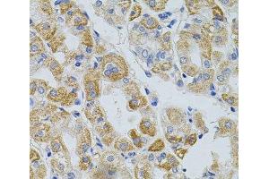 Immunohistochemistry of paraffin-embedded Human stomach using PCSK9 Polyclonal Antibody at dilution of 1:100 (40x lens).
